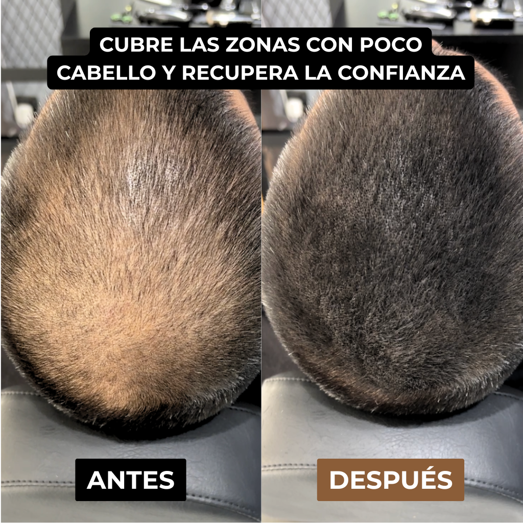 Camuflaje capilar Bracaru